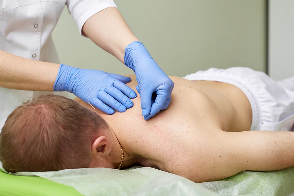 Рефлексотерапия